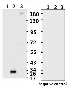 SARS-CoV-2 (COVID-19) Spike RBD Monoclonal Antibody [B002] (HRP)
