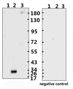 SARS-CoV-2 (COVID-19) Spike RBD Monoclonal Antibody [B002] (Biotin)