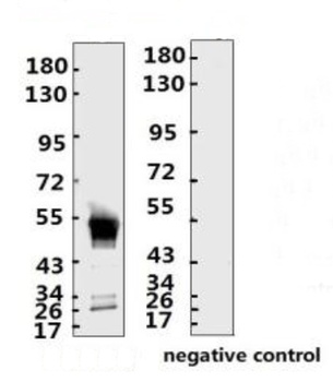 SARS-CoV-2 (COVID-19) Nucleocapsid Monoclonal Antibody [N016]