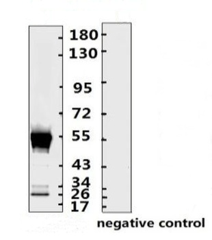 SARS-CoV-2 (COVID-19) Nucleocapsid Monoclonal Antibody [N015]