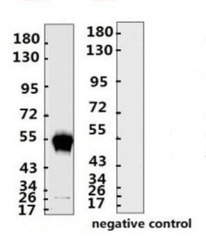 SARS-CoV-2 (COVID-19) Nucleocapsid Monoclonal Antibody [N014]