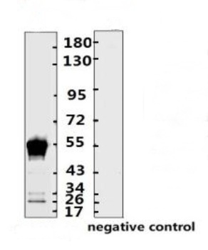 SARS-CoV-2 (COVID-19) Nucleocapsid Monoclonal Antibody [N013]