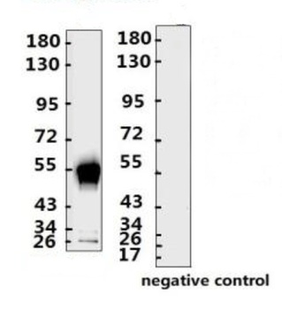 SARS-CoV-2 (COVID-19) Nucleocapsid Monoclonal Antibody [N012]