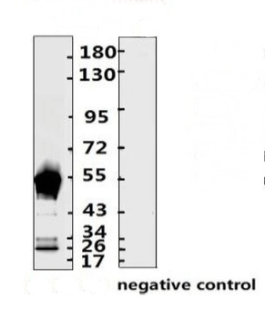 SARS-CoV-2 (COVID-19) Nucleocapsid Monoclonal Antibody [N010]