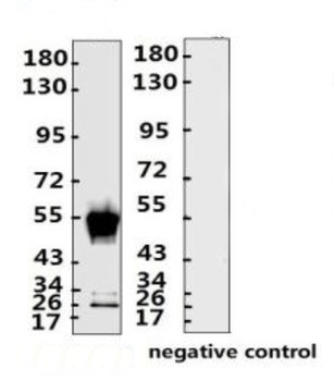 SARS-CoV-2 (COVID-19) Nucleocapsid Monoclonal Antibody [N009]