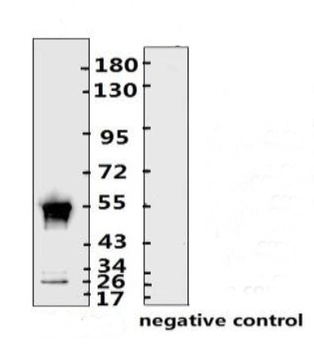 SARS-CoV-2 (COVID-19) Nucleocapsid Monoclonal Antibody [N008]