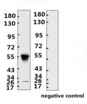 SARS-CoV-2 (COVID-19) Nucleocapsid Monoclonal Antibody [N007]