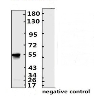 SARS-CoV-2 (COVID-19) Nucleocapsid Monoclonal Antibody [N005]