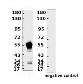 SARS-CoV-2 (COVID-19) Nucleocapsid Monoclonal Antibody [N004]