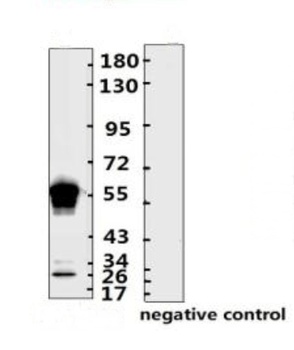SARS-CoV-2 (COVID-19) Nucleocapsid Monoclonal Antibody [N003]