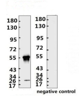 SARS-CoV-2 (COVID-19) Nucleocapsid Monoclonal Antibody [N002]