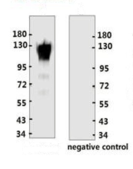 ACE2 Antibody