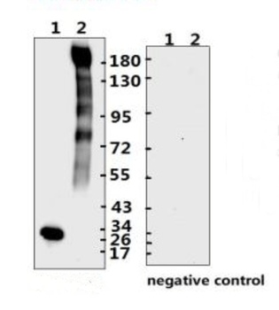 SARS-CoV-2 (COVID-19) Spike RBD Antibody