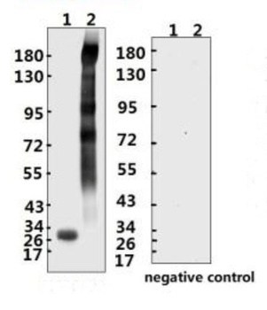 SARS-CoV-2 (COVID-19) Spike ECD Antibody