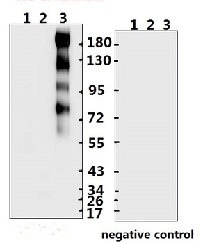 SARS-CoV-2 (COVID-19) Spike S2 Antibody (IN)