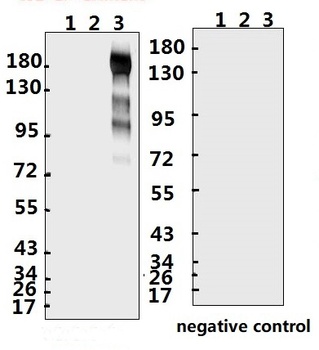 SARS-CoV-2 (COVID-19) Spike S1 Antibody (IN)