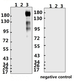 SARS-CoV-2 (COVID-19) Spike S1 Antibody (NT1)