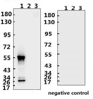 SARS-CoV-2 (COVID-19) Nucleocapsid Antibody (CT)