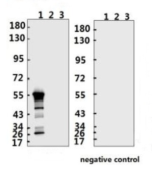 SARS-CoV-2 (COVID-19) Nucleocapsid Antibody (IN)