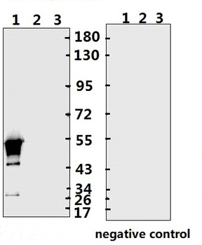 SARS-CoV-2 (COVID-19) Nucleocapsid Antibody (NT)