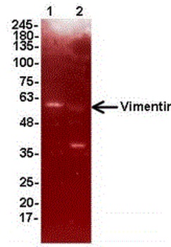 VIM Antibody