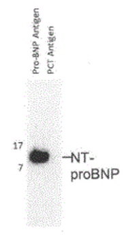 NT-proBNP Antibody [F10]