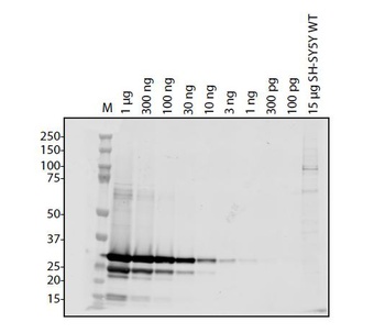 SARS-CoV-2 (COVID-19) ORF6 Antibody