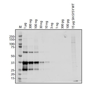 SARS-CoV-2 (COVID-19) ORF8 Antibody
