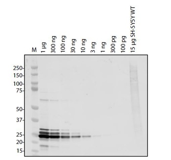 SARS-CoV-2 (COVID-19) ORF10 Antibody