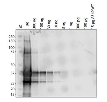 SARS-CoV-2 (COVID-19) NSP10 Antibody