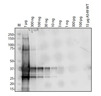 ORF1ab Antibody