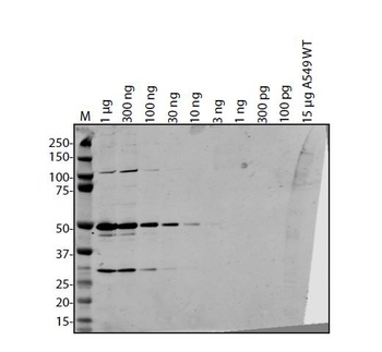 SARS-CoV-2 (COVID-19) ORF7B Antibody