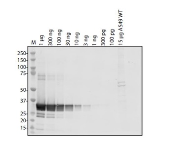 SARS-CoV-2 (COVID-19) NSP7 Antibody