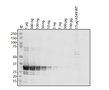 ORF1ab Antibody