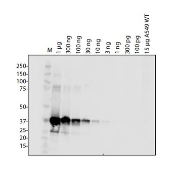 ORF1ab Antibody