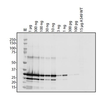 MERS Coronavirus (HSZ-Cc) Envelope Antibody