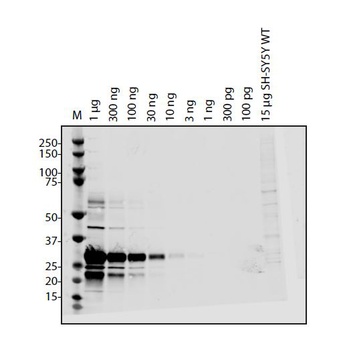 SARS-CoV-2 (COVID-19) ORF9B Antibody