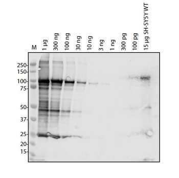 SARS-CoV-2 (COVID-19) NSP2 Antibody