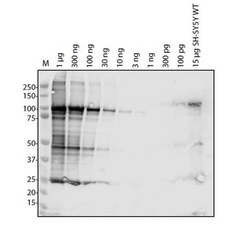 ORF1ab Antibody