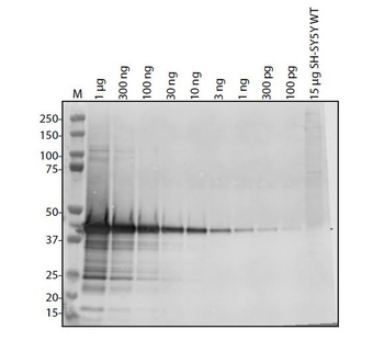 SARS-CoV-2 (COVID-19) NSP8 Antibody