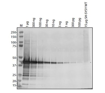 ORF1ab Antibody