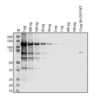 ORF1ab Antibody