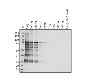 SARS-CoV-2 (COVID-19) NSP14 Antibody