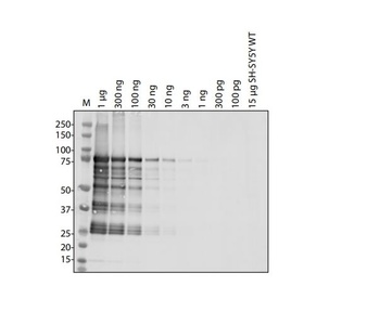 ORF1ab Antibody