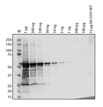 ORF1ab Antibody