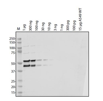 SARS-CoV-2 (COVID-19) Envelope Antibody