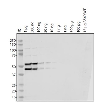 SARS-CoV-2 (COVID-19) Envelope Antibody