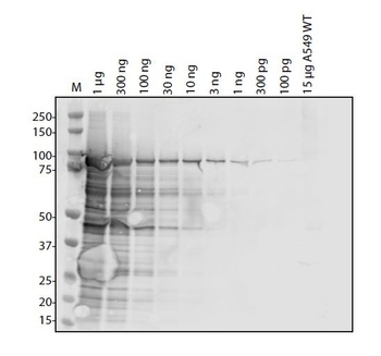 MERS Coronavirus (HSZ-Cc) Nucleocapsid Antibody