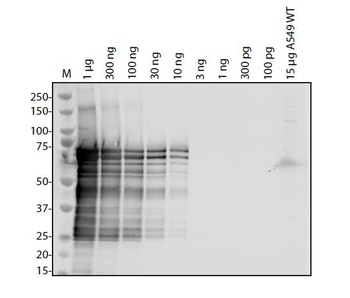 SARS-CoV-2 (COVID-19) Nucleocapsid Antibody