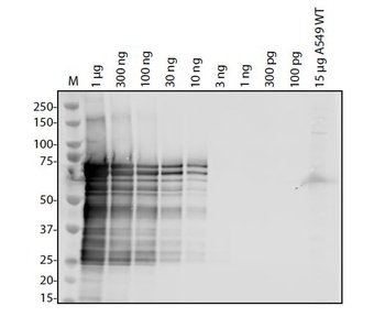 SARS-CoV-2 (COVID-19) Nucleocapsid Antibody